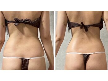 スリーピングビューティー(Sleeping Beauty)/