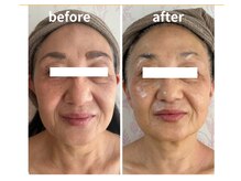 ウィッシュプロサロンケー(WISHpro salon K)/輪郭が別人級