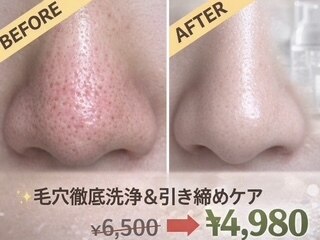 ミント｜ホットペッパービューティー