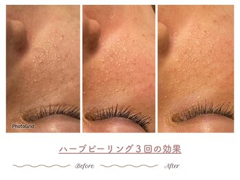 エステティックサロン シーズ/“育てる肌質改善”