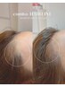 リタッチの方限定☆《7/5～10/31限定》ヘアライン [ M字 ] ￥38000→￥30000