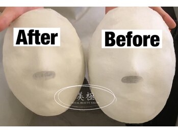 美極 トータルビューティー(美極 TOTAL BEAUTY)/恵比寿/小顔コルギ/エステ/