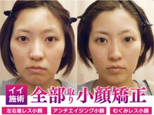 モアフェイス 池袋店(More Face)
