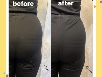 ヨサパーク ヴィラ デ ミューズ(yosa park villa des Muses)/みんな気になる下半身！