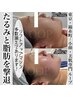 【リフトアップ】最新小顔マシンで気になる脂肪スッキリ解消！