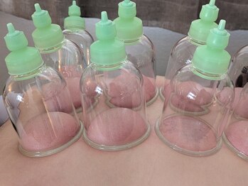 トーンファー:空/吸玉・筋膜スライドカッピング