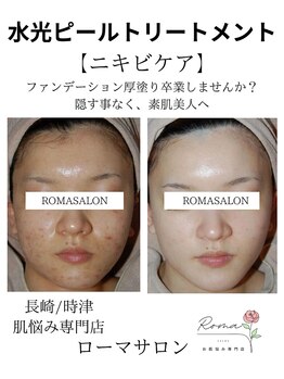 ローマサロン/ファンデーション厚塗り卒業!