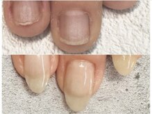 グラシナ 鳥丸店/爪先が変われば気分も明るく