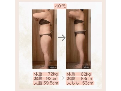 エメカシワ(Aimer KASHIWA)の写真