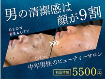 レオンザビューティー(REON the BEAUTY)