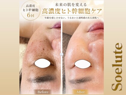 ソエルテ(Soelute)の写真