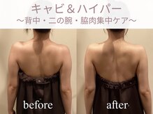 エステティックサロン アールグレー 名古屋駅店/ブライダル痩身◎ドレス映え！