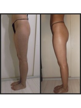 ビューティーライフ/痩せる、ボディライン綺麗になる