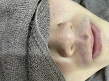 ナノハナ/鹿沼市全身脱毛美容室ナノハナ