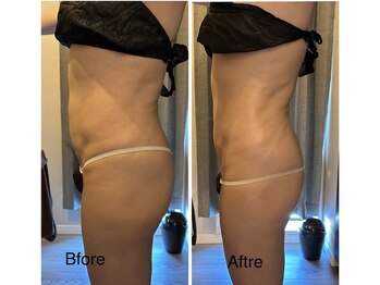 なまえのないエステサロン/一回での施術効果☆