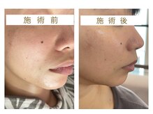 エスデザイン(es design)/くすみ改善／フェイシャル／谷山