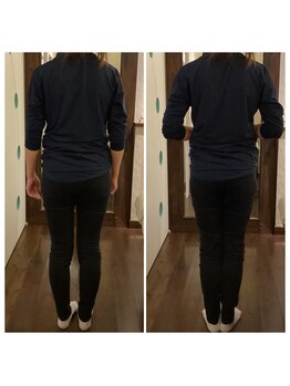 ヒカリノキュウジツ(Hikarino休日)/X脚調整