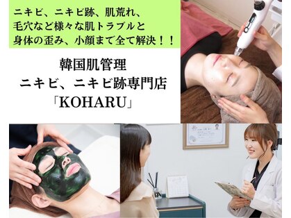 コハル(KOHARU)の写真