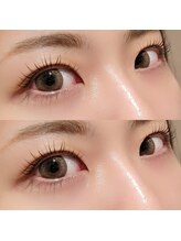 ジゼル(Giselle)/高持続◎毛質改善☆L3リフト