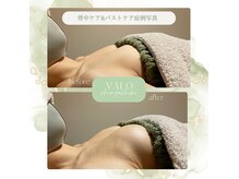 ヴァロ 熊本新屋敷(Valo)の雰囲気（今のあなたのバストのお悩みご相談ください！）