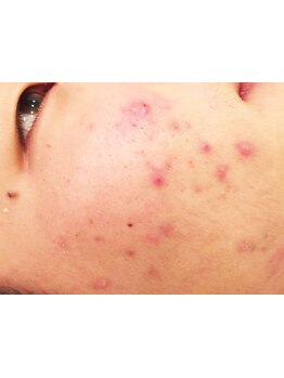 お肌をきれいにしたい