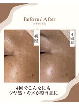 エムイーボーテ(me.Beaute)/【セルマン】キメが整いツヤ肌に