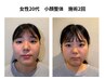 【エイジレス小顔整体！】結果重視の新感覚整体！お試し60分￥5500
