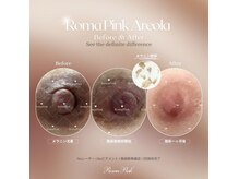 ティアラ(Tiara)の雰囲気(モニターの種類・割引率・募集状況は施術や時期により異なります)