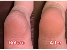 プクル(Pukul)/かかと角質ケア