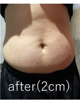 カナウ(kanau)/トリプルボディシェイプ