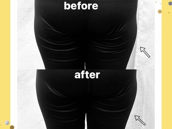 ヨサパーク ヴィラ デ ミューズ(yosa park villa des Muses)/どちらのお尻がいいですか？☆