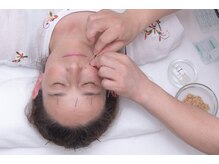 アキュパンクト ラボ 片山治療院(Acupunct Lab 片山治療院)/顔