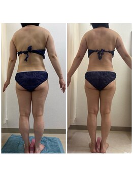 サロン ド ナナ/エンダモロジー8回コース