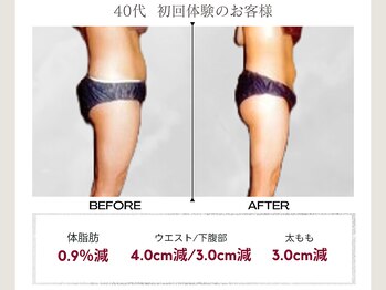 プレステージ 川崎店/マッサージ◆ビフォーアフター