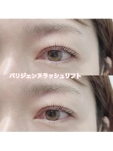 レディエント(Radiant)/パリジェンヌラッシュリフト