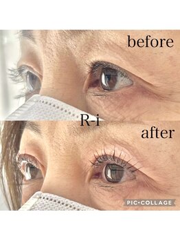 アールアイ(R-i)/