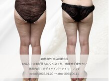 エメ(aimer)/BodyCare《痩身・代謝アップ》