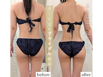 リアージュ(Riage)の写真