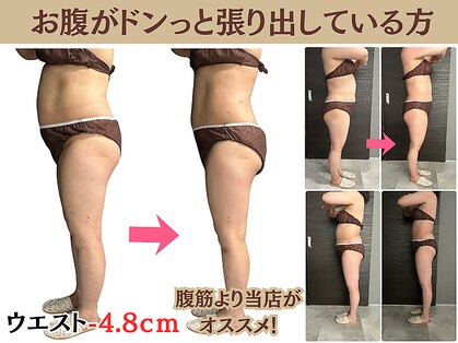 ヘッテ(Hette)の写真