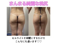 アプロディタの雰囲気（ダイエットの結果出しが得意♪親身なサポートお任せください♪）