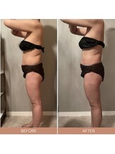 リファラ 光の森店(REFALA)/【痩身/40代女性】約3ヶ月の結果