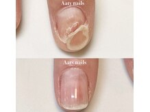 アーティネイルズ(Aaty Nails)