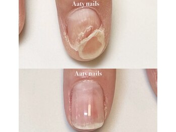 アーティネイルズ(Aaty Nails)