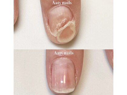 アーティネイルズ(Aaty Nails)の写真
