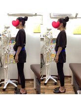 ヒデ整体院(Hide整体院)/腰痛　反り腰改善　姿勢骨盤矯正