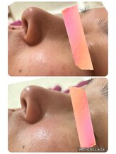 プレシャス(precious)/毛穴の汚れや皮脂