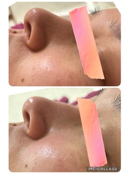 プレシャス(precious)/毛穴の汚れや皮脂