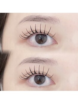 アテプラス(ate+)/パリエク120本