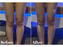 サロンビー 赤坂(SalonB)/美脚/浮腫改善/立ち仕事の方に