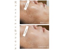 シミ、しわ、毛穴、敏感肌など、お肌のお悩みをご相談ください